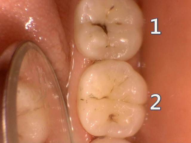 8b6fda109d91d8447b7d451278611fbe_1476843917_6155.jpg