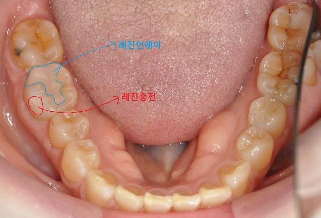 23dd68d58ab7a2723a66d401fb62efa9_1478512592_7967.jpg