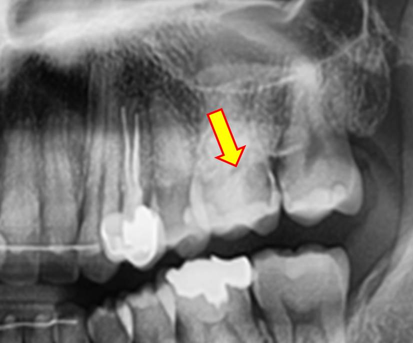 36ddcbcf7d2ca4633822edcab8db72c1_1608619779_1993.jpg